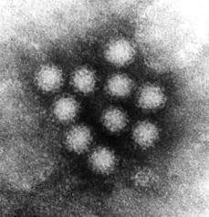 Photo of the virus with thanks to the Environmental Protection Agency - US Federal Government,